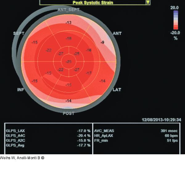 Strain-Analyse