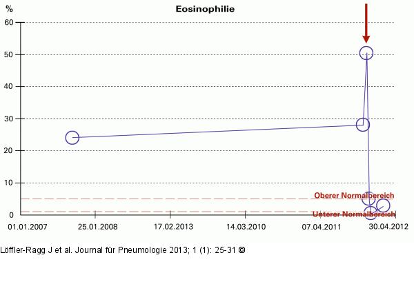 Eosinophilie