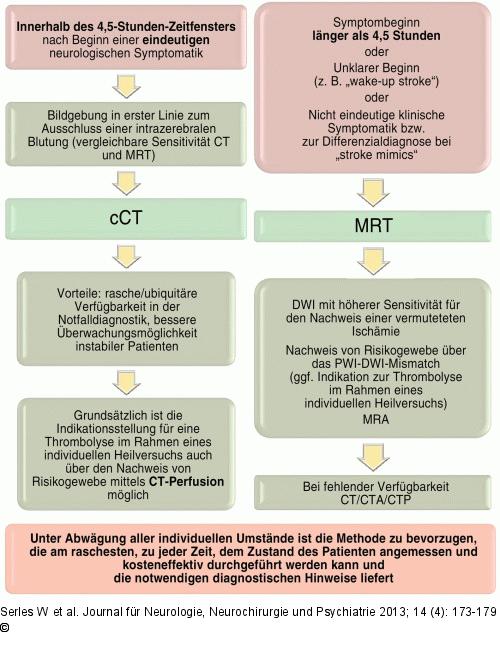 Schlaganfall-Behandlungsalgorithmen