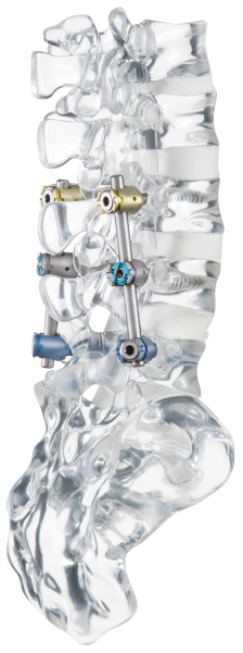 Produkt: uCentum(R)<br>Vertrieb: Ulrich GmbH & Co. KG
