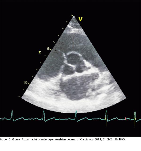 RVOT