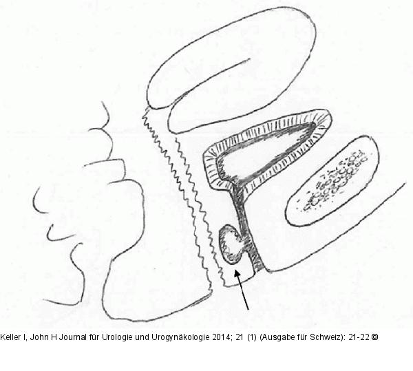 Harnröhre