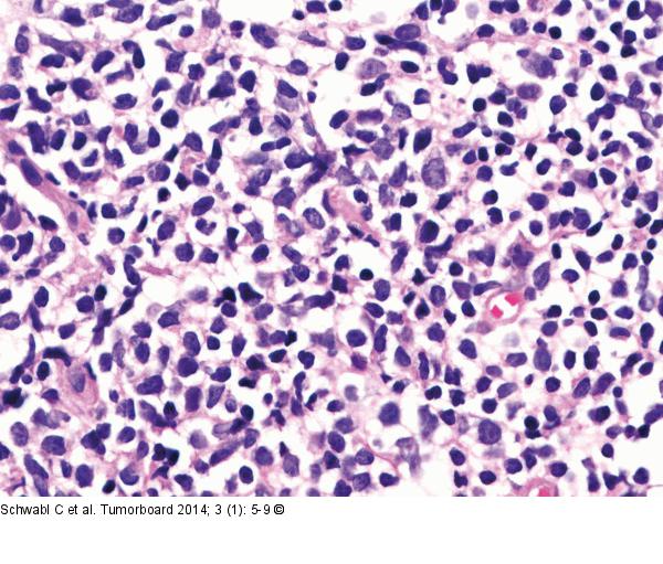 Follikuläres Lymphom