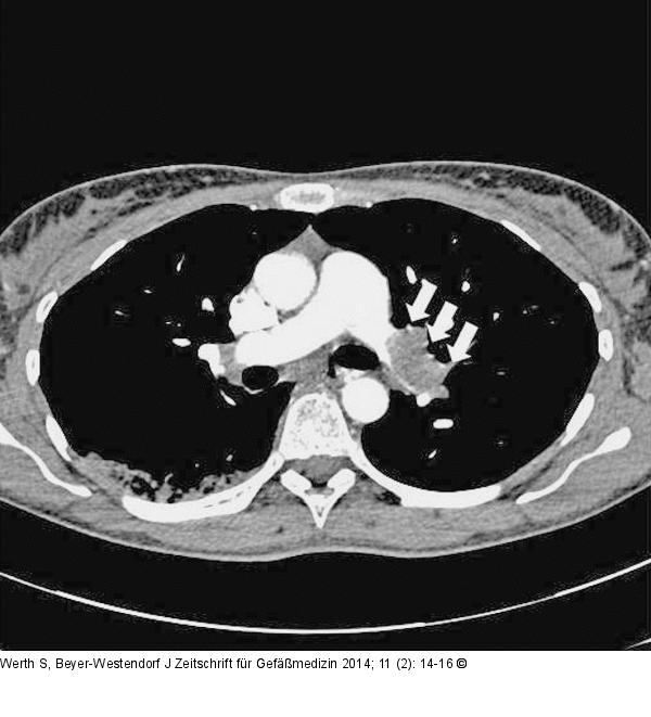 CT-Angiographie