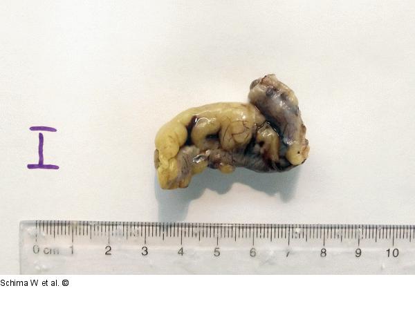 Appendix