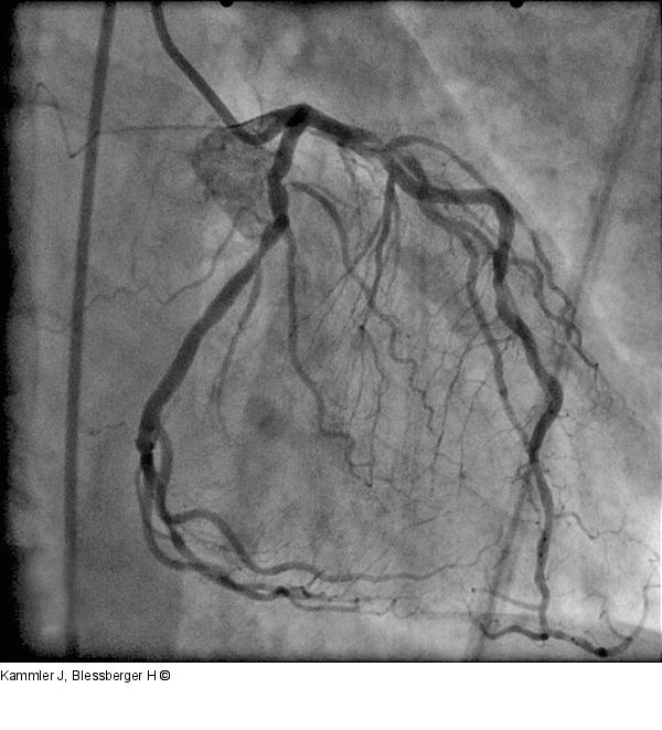 Angiogramm
