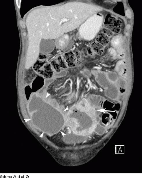 MDCT - 3D