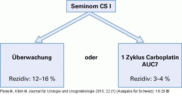 Hodenkarzinom-Therapie