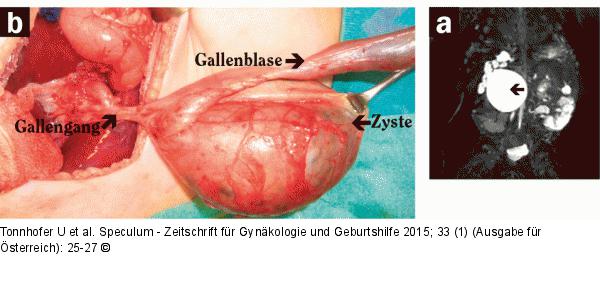 Pränataldiagnostik-Therapie