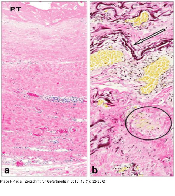 Histologisches Präparat