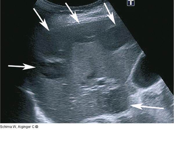 Sonographie - Leber