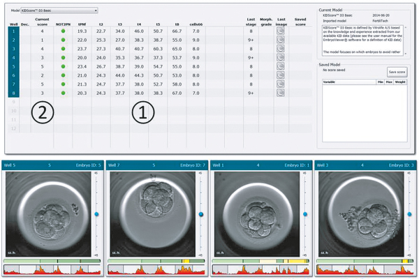 Produkt: EmbryoScope<br>Vertrieb: MTG Medical