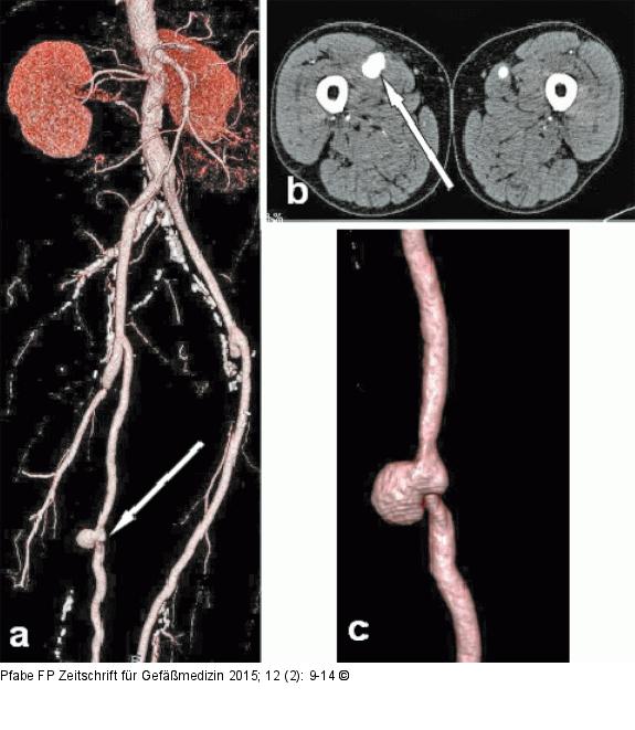 CT-Angiographie