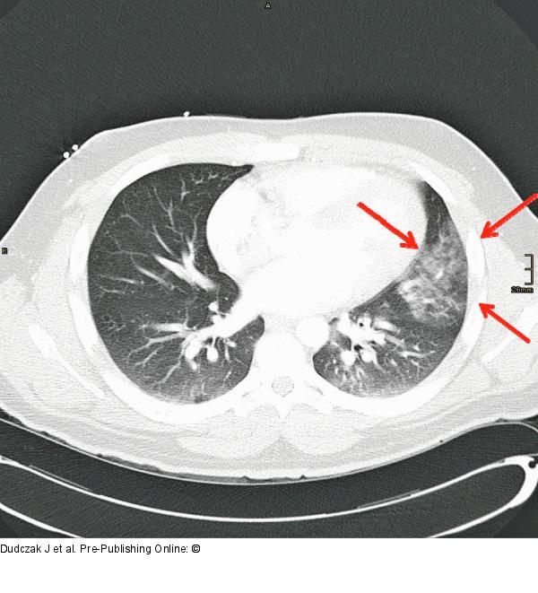 CT-Thorax