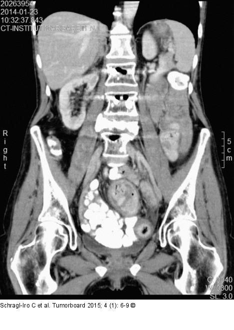 CT-Abdomen