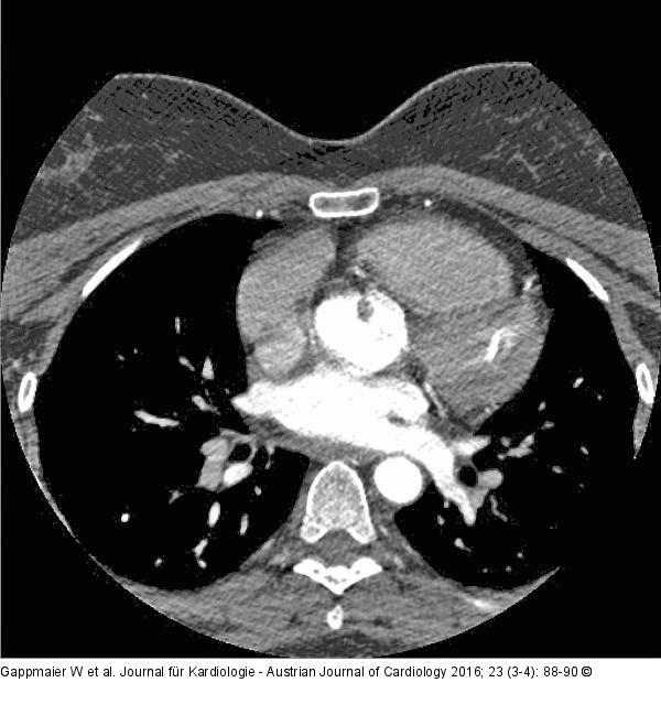 CT-Angiographie