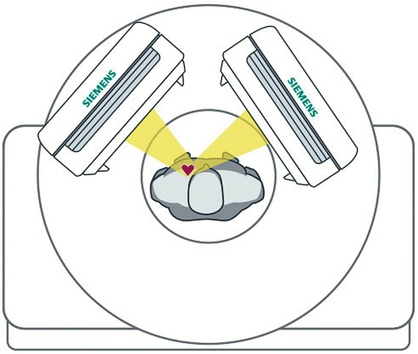Produkt: IQ.SPECT<br>Vertrieb: Siemens AG