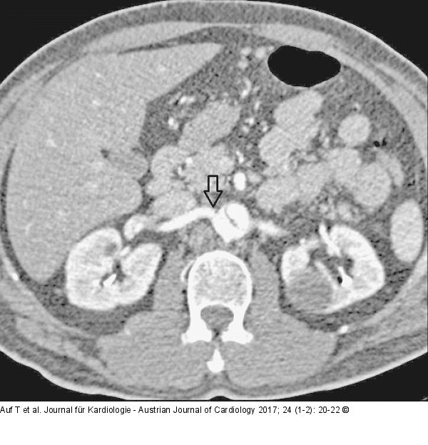 CT-Angiographie