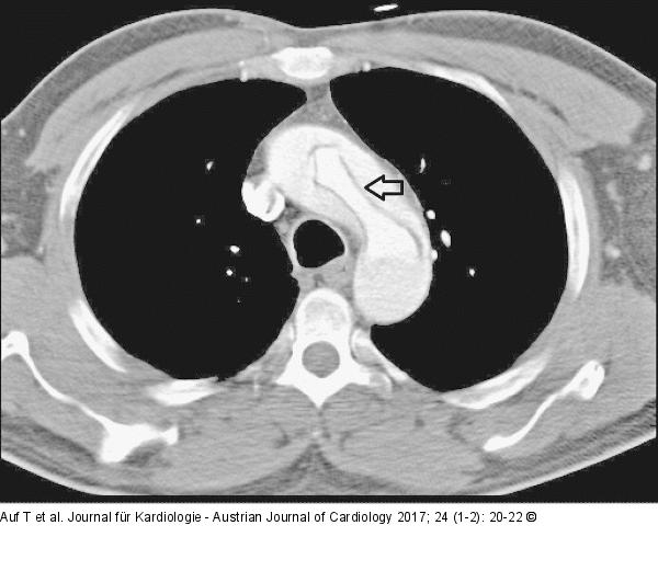CT-Angiographie