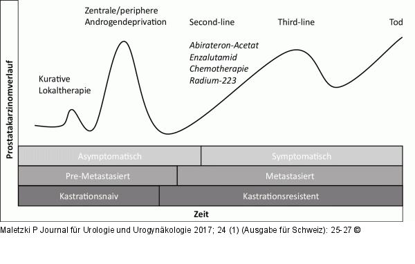 Stadiengerechte Therapie