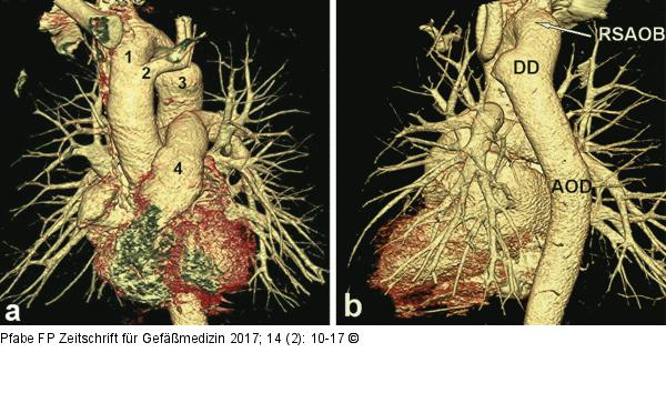CT-Angiographie