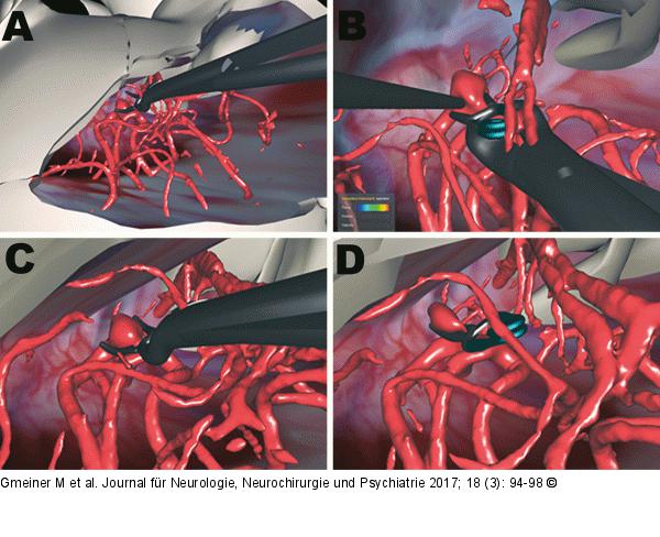 Virtuelle Operation