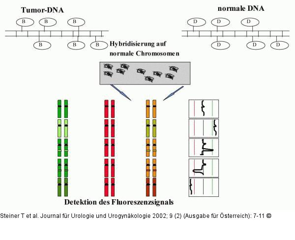 Vergleichende genomische Hybridisierung