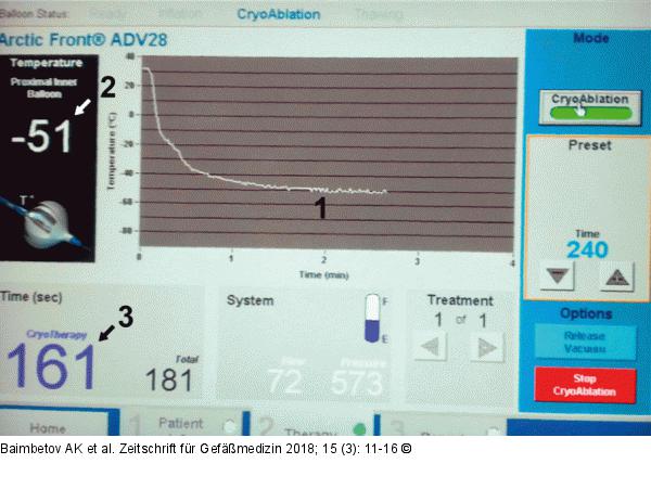 Cryoconsole display