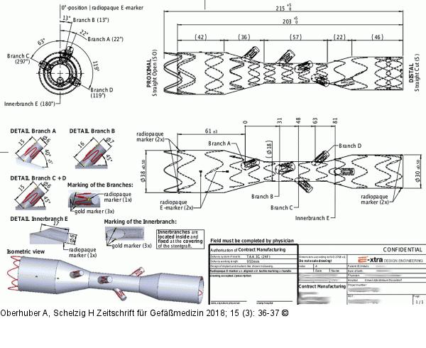 Produkt: Stentgraft<br>
Vertrieb: Jotec GmbH