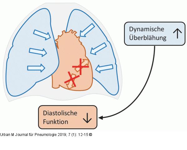 COPD