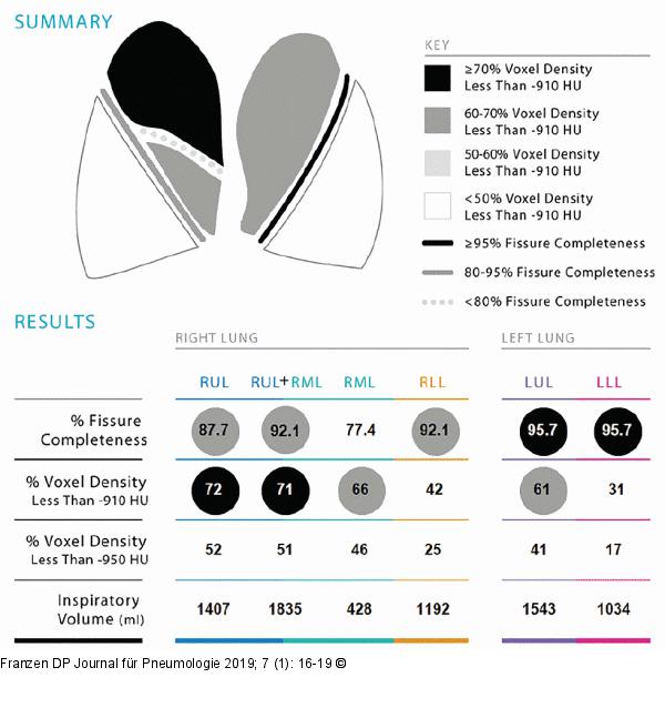 Quantitative CT
