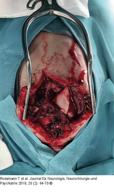 Intraoperative Fotografie