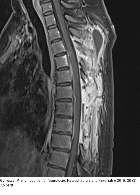 Postoperative MRT-Bildgebung