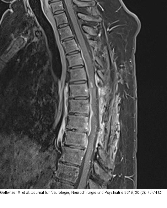 Postoperative MRT-Bildgebung
