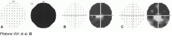 Perimetrie