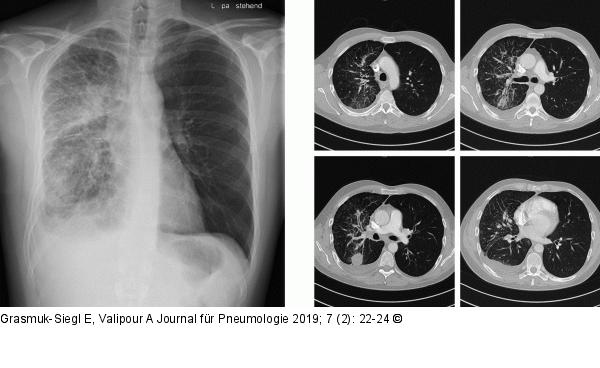 Radiologie