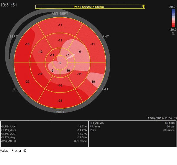 Bull's Eye-View 