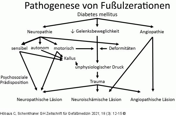 Fußulzeration