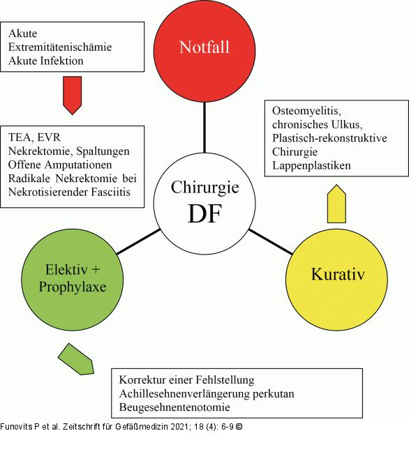 Chirurgie - Diabetischer Fuß