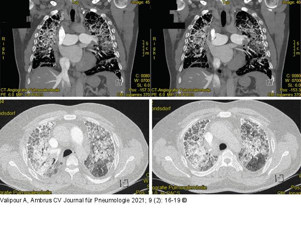 CT-Angiographie