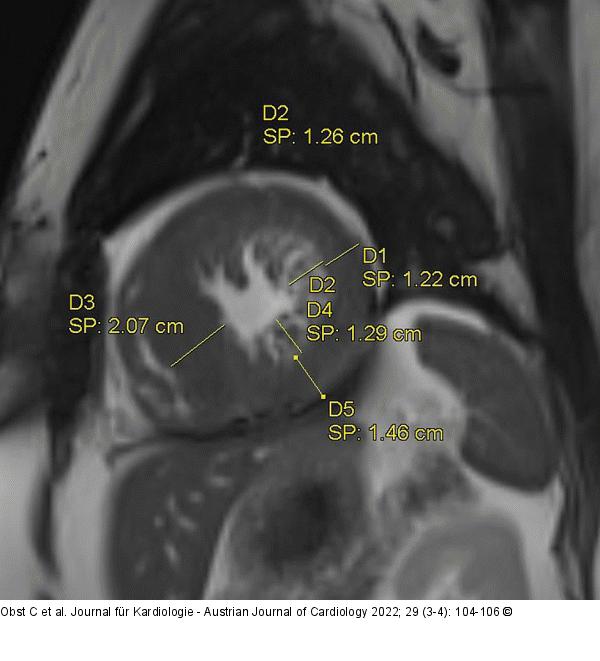Short-axis view