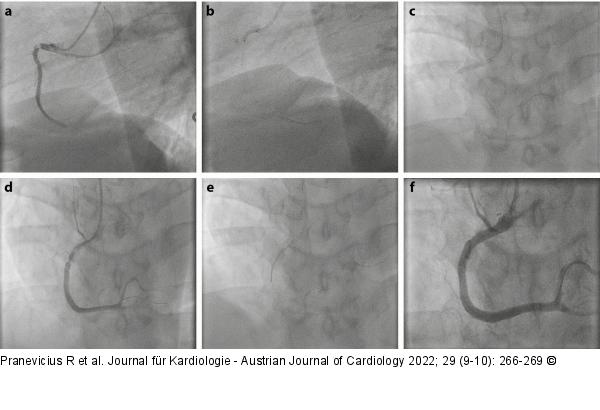 Angiogramm