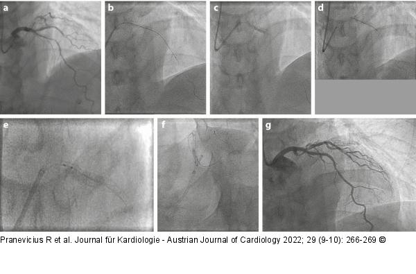 Angiogramm