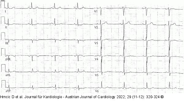 Ruhe-EKG