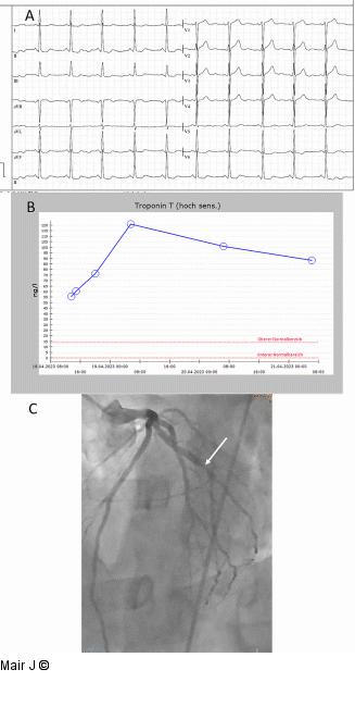 Arterielle Blutdruckentgleisung - Online-Abbildung 2 