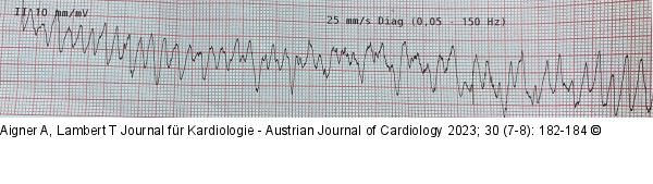 EKG - Reanimation
