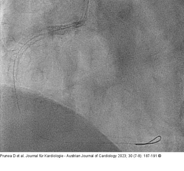 Angiographie
