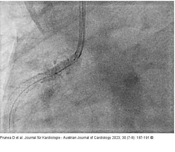 Angiographie