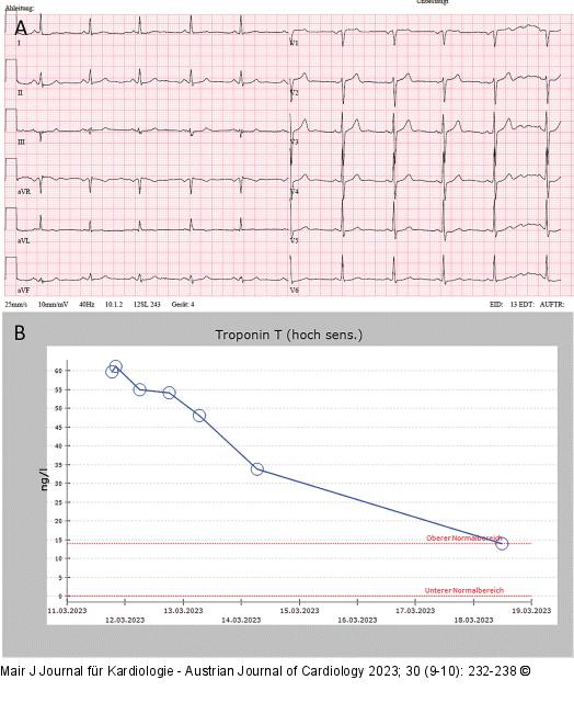 Troponin T - Print-Abbildung 4