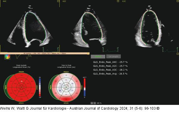 Echo